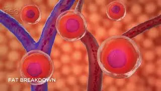 Emsculpt Neo VIDEO