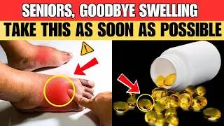 Seniors, Say Goodbye to Swollen Legs with THIS 1 Vitamin - Works in Days!