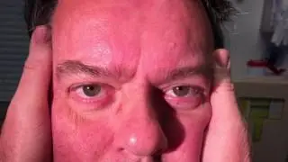 Patient 2 Head Impulse Test