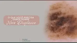 O que você precisa saber sobre Nevo Displásico: