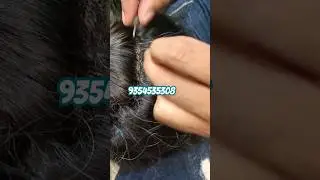 White hair patch  manufacturing #shorts #hair #trending