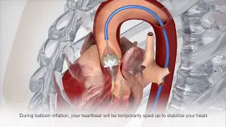 Cardiac Catheterization - Patient Treatment