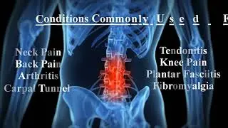 Deep Tissue Laser Therapy at Balance Chiropractic and Wellness Center