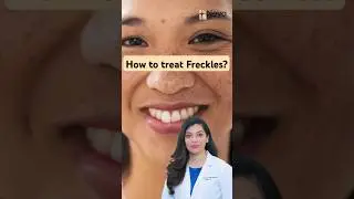 How to treat Freckles on Face | Freckles removal #frecklesface #freckles