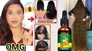 OMG 😱 Only 5 Days Work ..Fast Hair Grow 😲Regrow Hair ..Phillauri Ginger Hair Nutrients Solution..