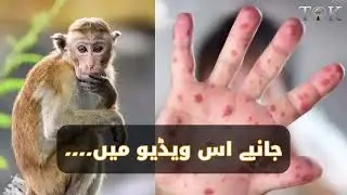 First Confirmed Monkeypox Case in Karachi - All You Need to Know | Karachi