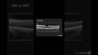 Macular OCT Practical Discussion 2 17