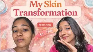 Glowing Skin In 30 Days | My Skincare Routine | Skin Transformation | Healthy Skin
