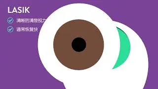Refractive Options without SMILE- Mandarin Version