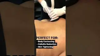 Our Favorite Fat Reduction Treatment!