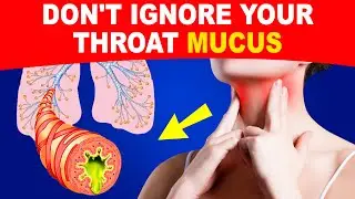 AVOID THESE 5 FOODS to Stop Phlegm Buildup in Your Throat