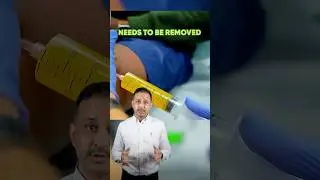 SWOLLEN KNEE- Why does it happen? #drpankajwalecha #kneepain #swelling