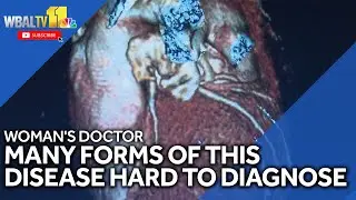 Vascular disease can be hard to diagnose