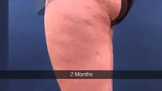 CelluSmooth Time Lapse Video