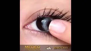 Medeo Lens Ring Grey