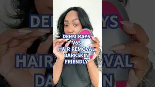 #laserhairremoval #blackgirlbloggers #skincaretips #hairremovalforwomen #safe #melaninskincare