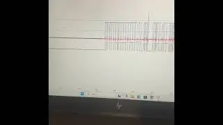 Diagnosing CAN Bus Networks with Picoscope (Shorts and Opens) On A 2013 Ford Fiesta