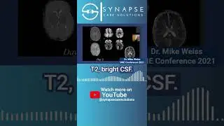 Case Study #1   38 week infant, MRI post rewarming