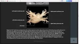 CHEST ABDOMEN IMAGING  ANATOMY