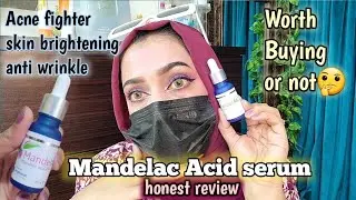 Mandelic Acid serum honest review || acne Fighter || black/white heads removal #honestreview #useage