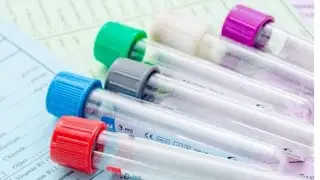 कोनसी Vials में कोन सा sample जाएगा kase पता करे ?Vacutainers ! #bloodsample #bloodvials #viralvideo