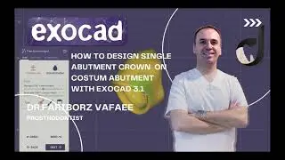 How to design single crown like a pro in exocad 3.1