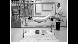 Cotrel&rsquo;s frame; orthopedic device in Elongation Derotation Flexion EDF casting technique