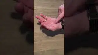 MSVRG - FINGER TEST FOR CHECKING THE DONENESS OF STEAK