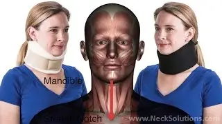 Foam Collars