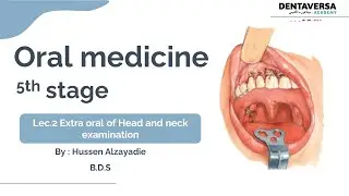 Oral medicine 5th lec2 Extra oral of Head and neck examination  2026