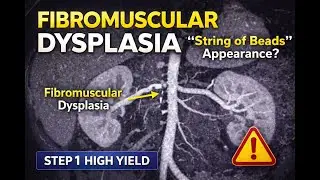 If You Miss This Renal Artery Disease, You&rsquo;ll Miss the Question | Step 1
