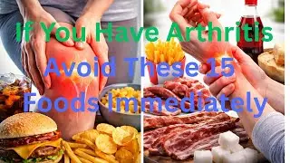If You Have Arthritis, Avoid These 15 Foods Immediately
