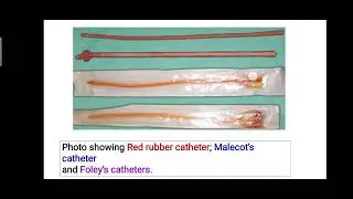 HEMATURIA; CATHETERIZATION & DIGITAL RECTAL EXAMINATION (DRE)