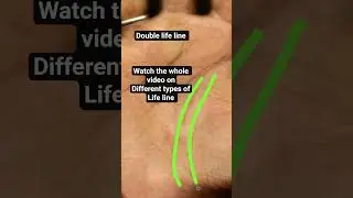 double lifeline watch the whole video on different types of lifeline
