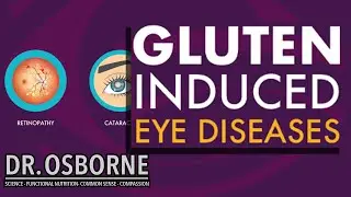Gluten Induced Eye Diseases Related to Malnutrition/Malabsorption