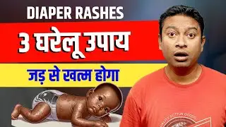 How to cure diaper rash? Diaper Rashes Home Remedy In Hindi | Bhavika Trails