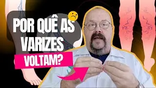 Varizes: Como Acabar com a Dor e as Varizes de vez, Melhorando a Apar&ecirc;ncia das Pernas!!!