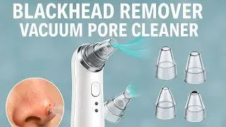 Top 5 Best BLACKHEAD REMOVER VACUUM PORE CLEANER | Deep Clean Pores Instantly! On Aliexpress On Amaz