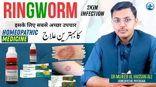 Ringworm Treatment in urdu || Homeopathic Treatment for Ringworm Skin Infection