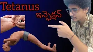 Tetanus infection complete details in Telugu #tetanus #infection