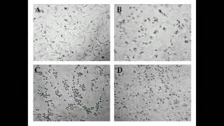 An insight into cytotoxic and antimicrobial effects of Cystoseira humilis crude extract