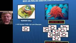 INTRO ON PET AND VERSATILITY OF RADIOACTIVE GLUCOSE