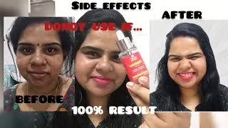 ഒരു GLASS SKIN കഥ😳 CHICNUTRIX outshine serum honest REVIEW & DEMO #whiteningserum #chic #glassskin