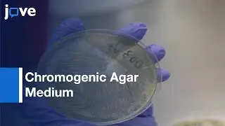 Chromogenic Agar Medium for the Detection of Vibrio Species | Protocol Preview