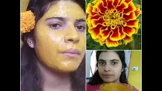 DIY : MARIGOLD INSTANT FAIRNESS AND ACNE FIGHTING FACEPACK