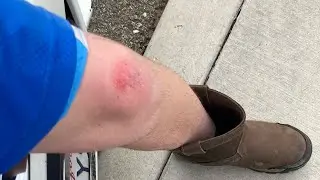 OUCH MOMENTS: WORST SWINGS ACCIDENT THAT WAS SURVIVABLE