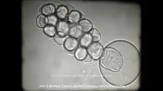 The dinoflagellate Chytriodinium from Villefranche sur Mer by Cachon and Cachon