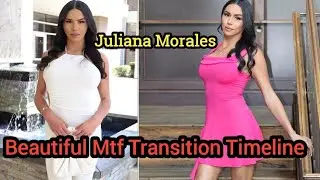 Beautiful Mtf Transition Timeline || Boy To Girl  Transformation || Men Become Women ||Trans Studio