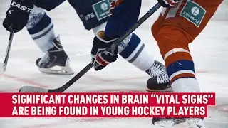 Repetitive head impacts in youth hockey lead to significant changes in brain function
