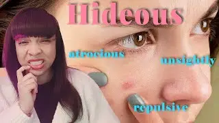 What a HIDEOUS zit! | Learn Real words from Real American Enlgish!